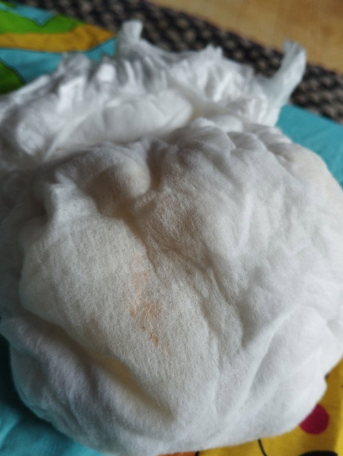 Bercak oren di pampers bayi kenapa ya? Ada yg pernah ngalamin?