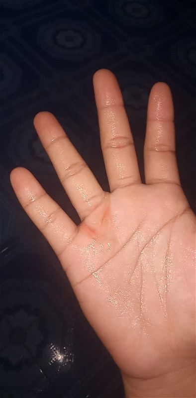 38สัปดาห์แล้วมีแบบนี้ออกหมายความว่ายังใงคะ