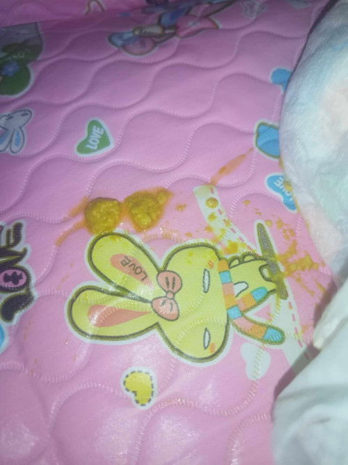 Mga mi ftm po worried po ksi