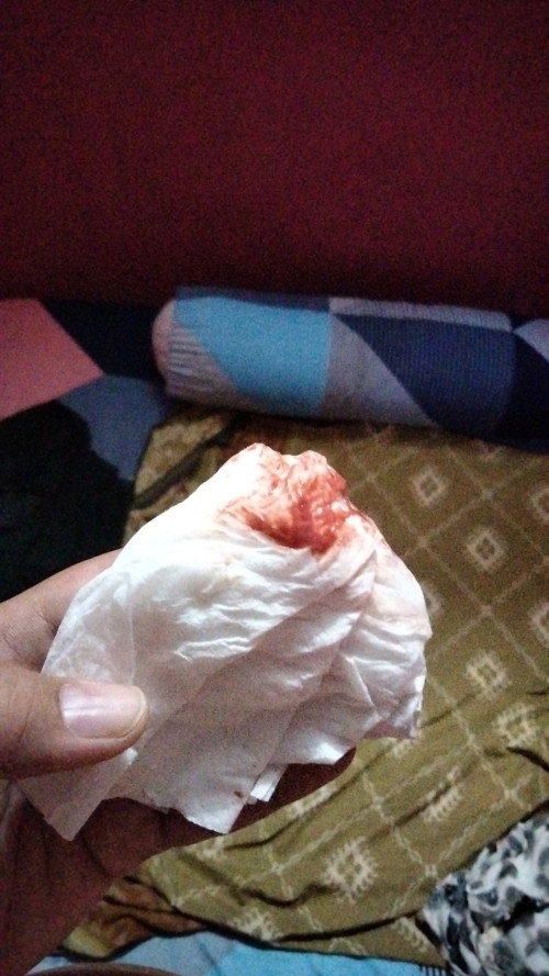 38W5D keluar darah campur lendir
maaf jorok🙏