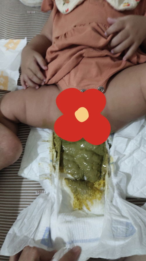 Seperti apa bayi disebut diare