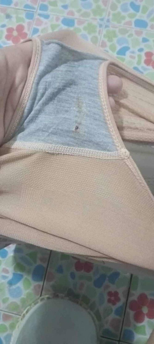 มูกเลือด แบบนี้