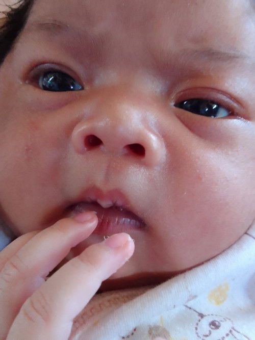 เพิ่มน้ำหนักลูก