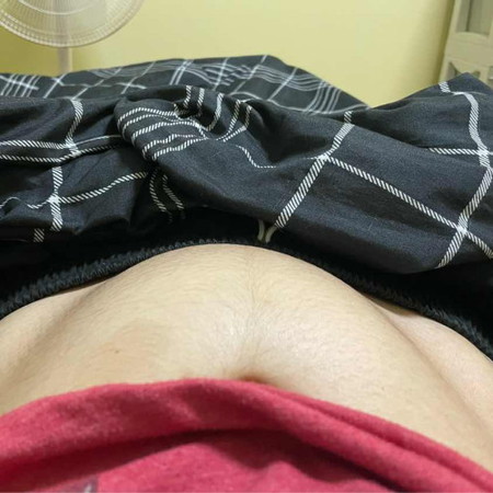 ท้องเป็นแบบนี้คืออะไรคะ