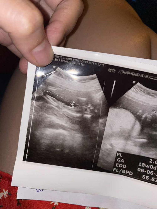 ทายเพศลูกให้หน่อยค่ะ