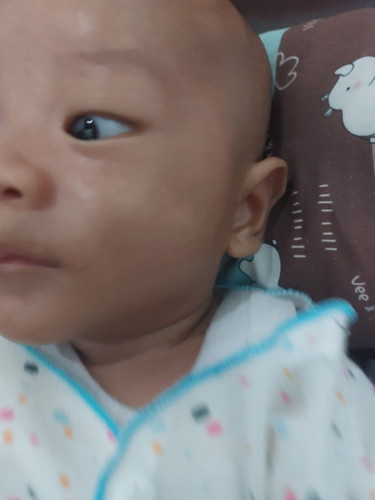 Bayi usia 2 bulan