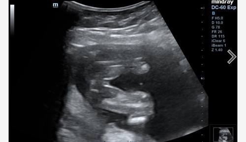 Girl or boy