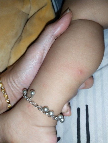 Hi mommies, boleh tau penyakit apa ini?