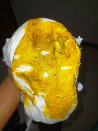 ขอสอบถามหน่อยค่ะ ถ้าอึแบบนี้ปกติมั้ย