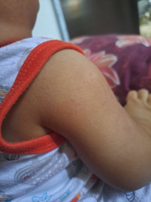 kulit kering dan kasar