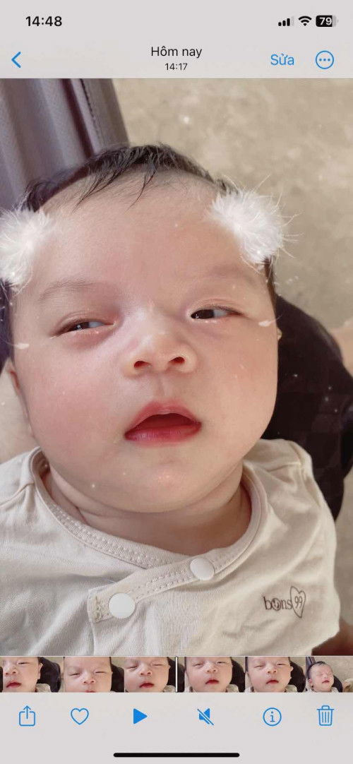 🍑 Tương lai mắt 2 mí hay hàn quốc đây ạ ??? 😄