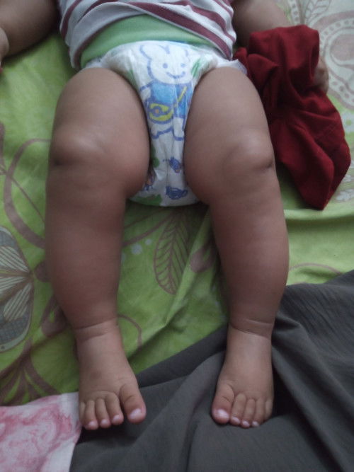 Kaki bayi 6bulan