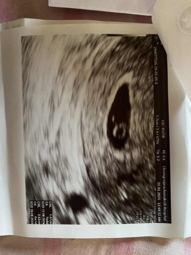 ท้อง8Wนับจากประจำเดือน