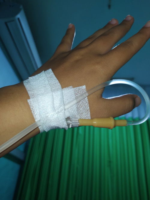 Servical Incompetens