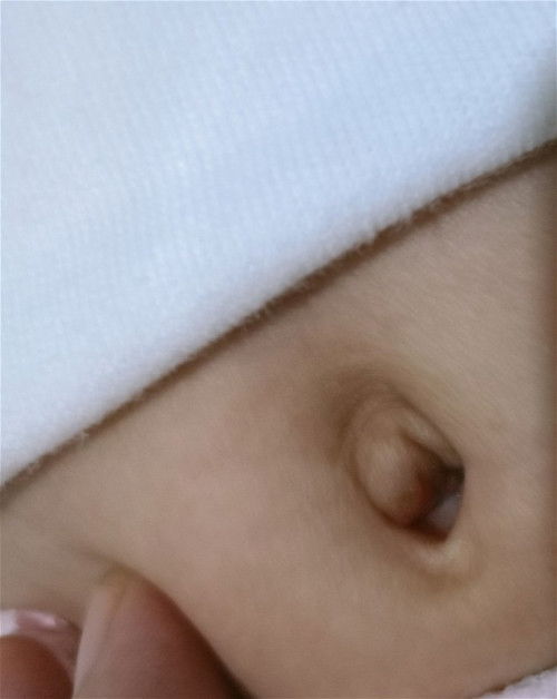 Ano po kayang dapat gawin? Normal ba 'to?