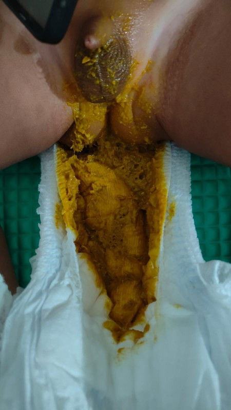 Pup bayi 10 bulan encer