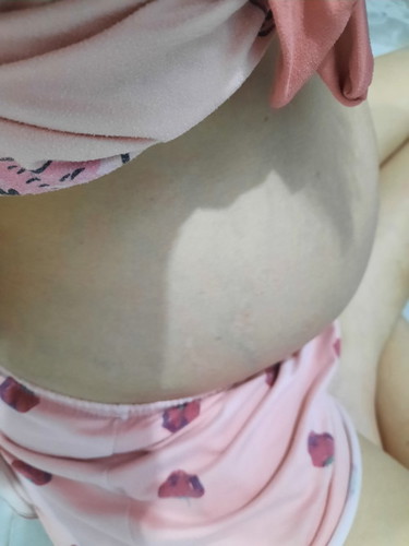 ท้องที่ 4
24 week