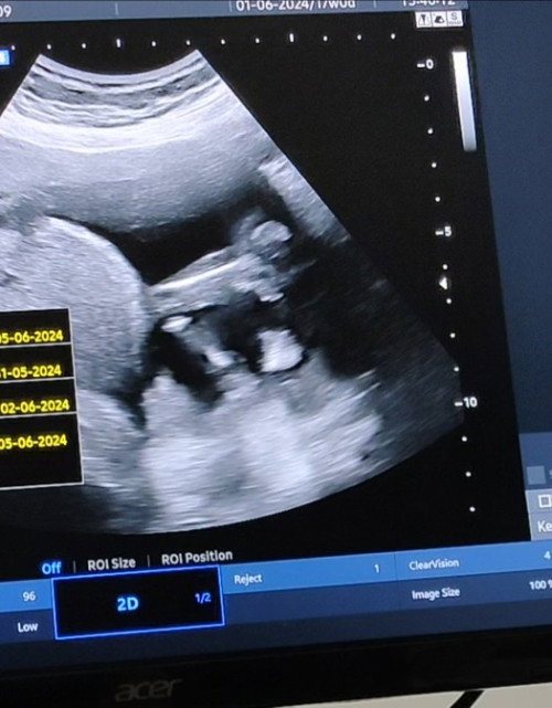 ชายหรือหญิงค่ะแม่ช่วยดูหน่อยค่ะ