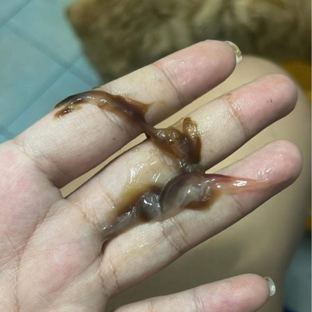 สอบถามค่ะมีมูกแบบนี้