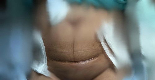 Question for CS moms