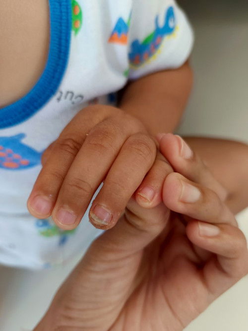 May same case po ba sa baby ko? Sugat sa daliri