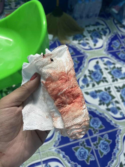 ตั้งครรภ์6สัปดาห์ มีเลือดออกช่องตลอด