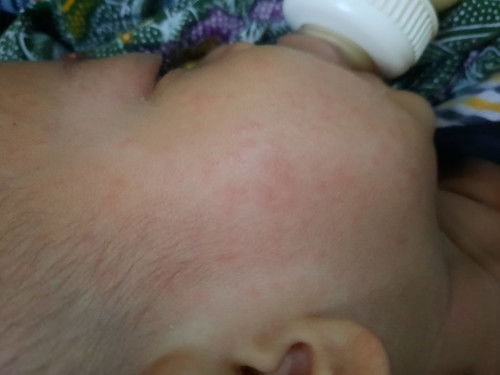 Akibat ganti susu atau keluar gigi geraham?