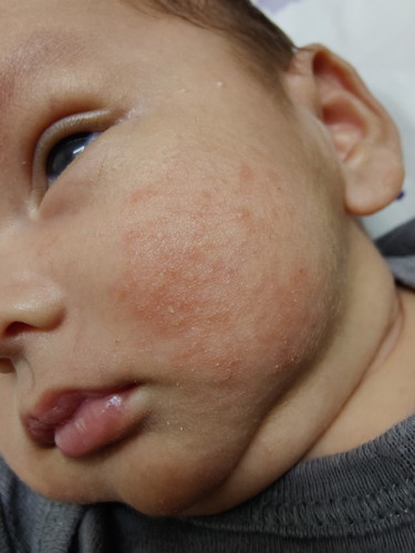 Kulit Bayi