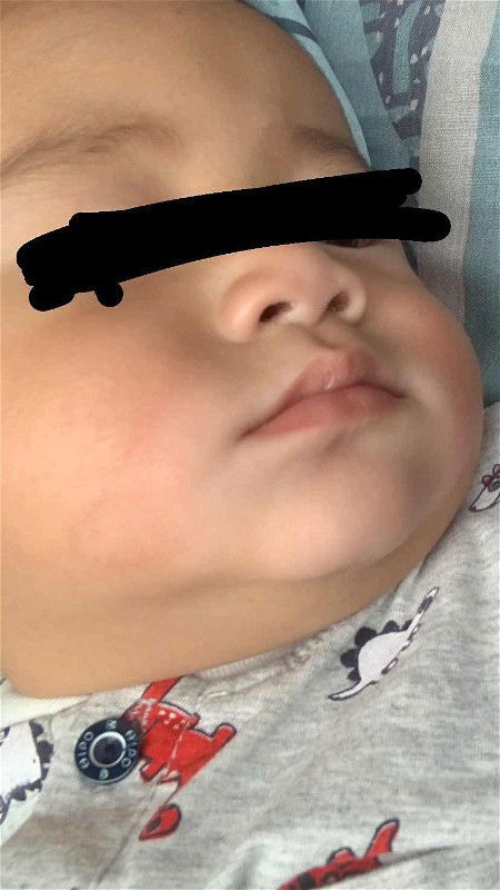 Putih sekitar dagu mulut