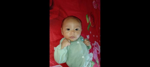 Bentuk kepala dan lingkar kepala