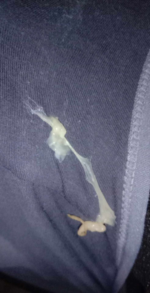 Mga ilang days kayo bago manganak kapag 1cm at 37weeks tapos nilabasan kayo ng ganito