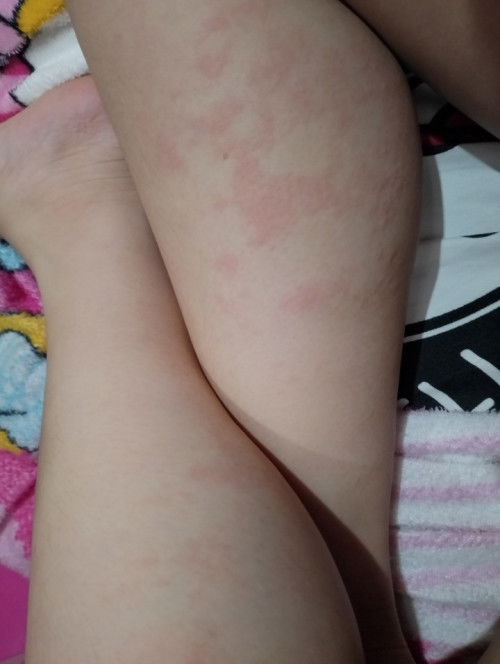 Pantal at Makati pagtapos Manganak