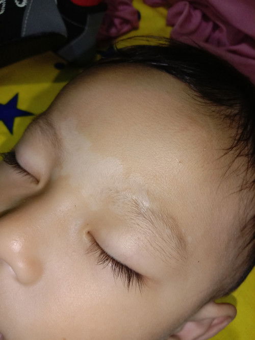 Tanda putih di kening