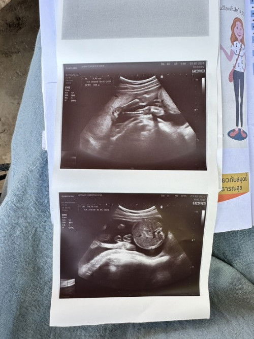 แม่ๆช่วยดูหน่อยค่ะ