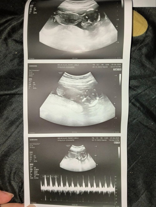 BOY OR GIRL?