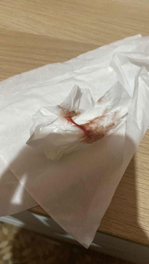 38 weeks kehamilan keluar flek