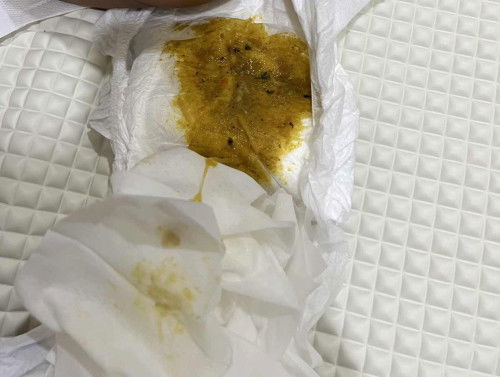 Bayi membuang kuning lendir. Tolong saya mommies