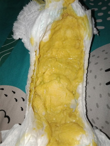 Pup bayi 7 bulan warna kuning pucat dan banyak