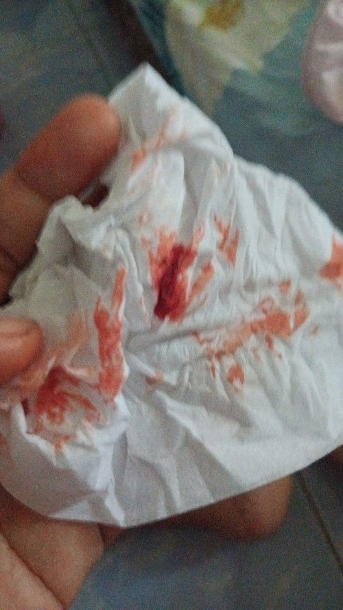 Pendarahan tanpa kontraksi apa bunda bunda ada yang mengalami