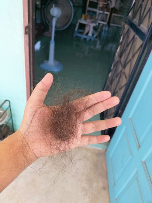 ผมร่วงเยอะมาก