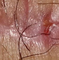 Para po sa cs mom Need po ba ipacheck up pag ganito? 1 month palang po ako