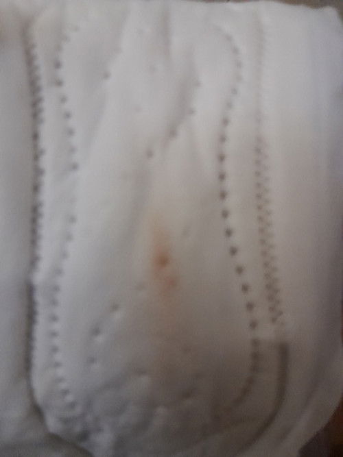 Mình ra ít máu  thế này có phải sắp sinh