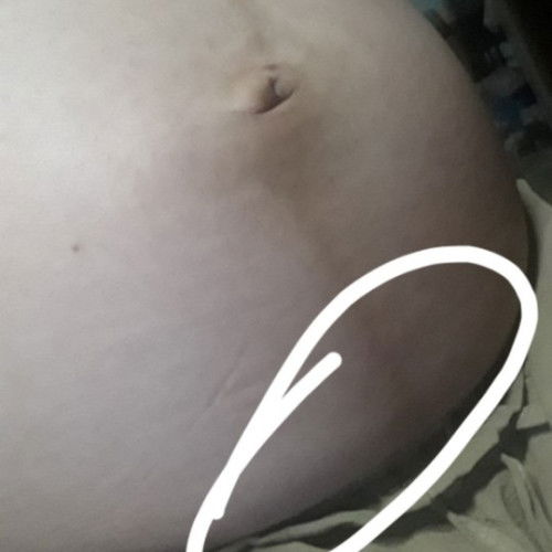 รู้สึกหน่วงๆตรงที่วงกลมไว้ รู้สึกปวดบิด กลัวน้องออกก่อนกำหนด จะเป็นอะไรไหมถ้าปวดตรงที่วงไว้