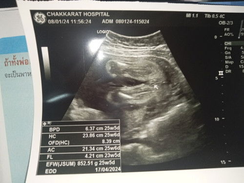 แม่ๆช่วยดูหน่อยค่ะ หญิงรึชาย