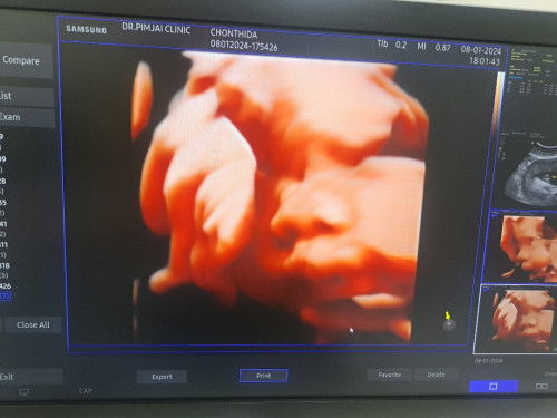 แม่ๆท่านอื่น น้ำหนักลูกเท่าไหร่แล้วคะ