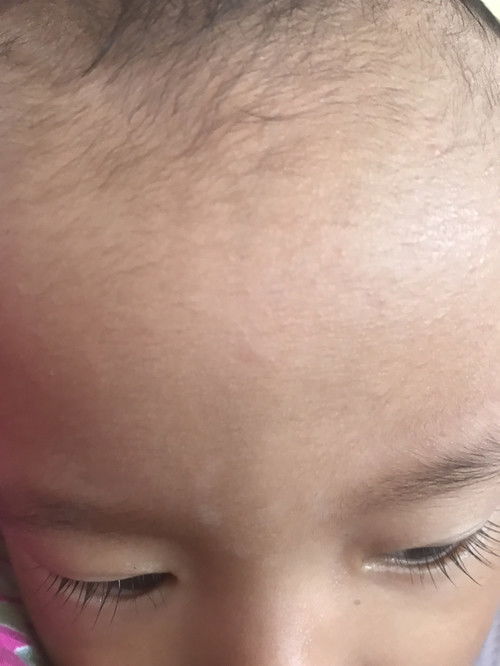 Bercak putih di wajah bayi