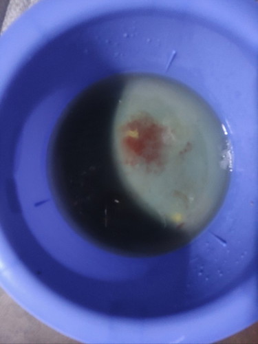 7mos pregnant bleeding or spotting