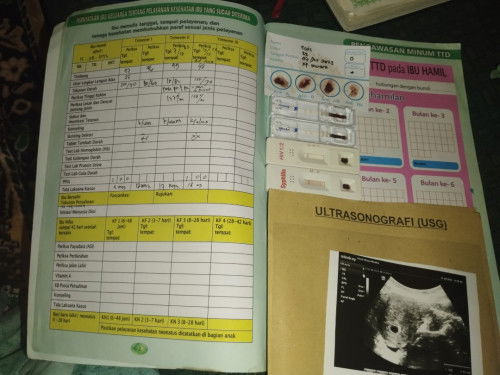 Bun serius tanya,klo kena hepatitis apa boleh setelah melahirkan nanti menyusui dini?