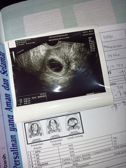 Hamil BO
Bantu sharing bun