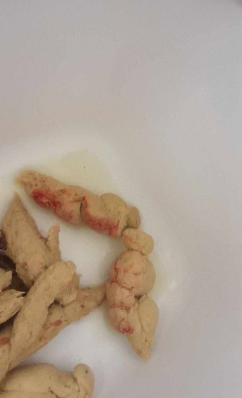 อึปนเลือด